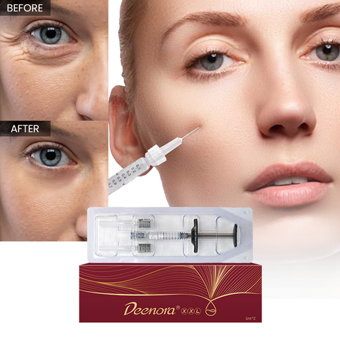 Newest Deenora XXL Hyaluronic Acid Filler the 2nd Generation